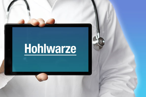 Schlupfwarzenkorrektur Passau